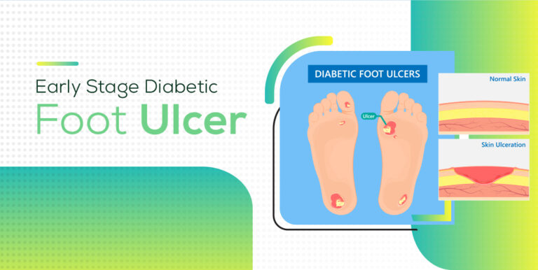 Early Stage Diabetic Foot Ulcer